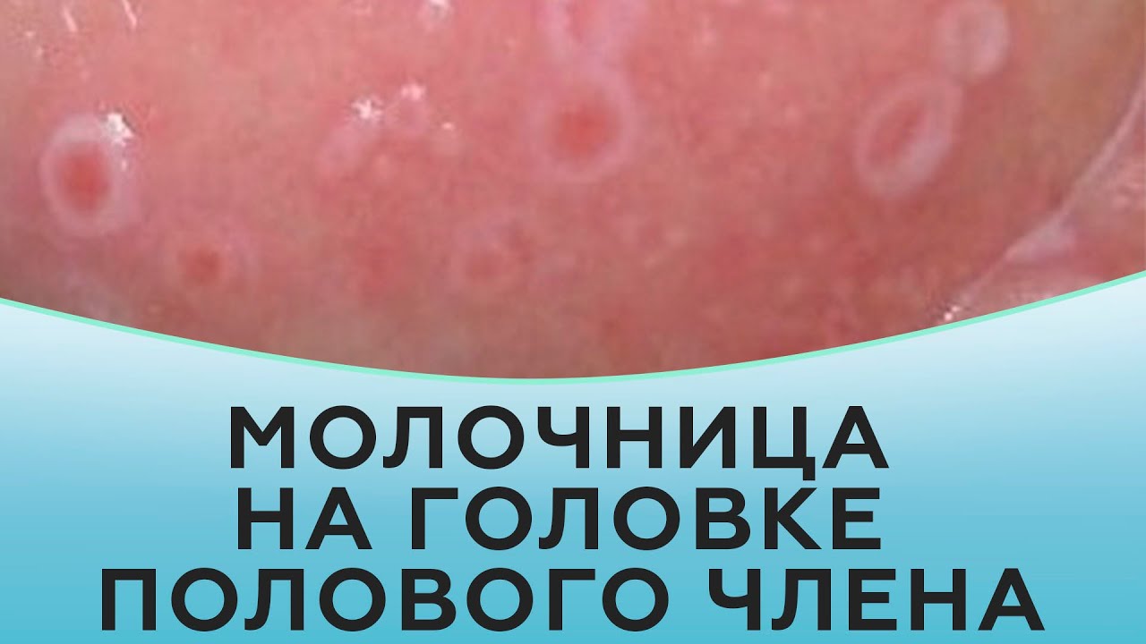 Как продлить половой акт у мужчин - методы продления времени