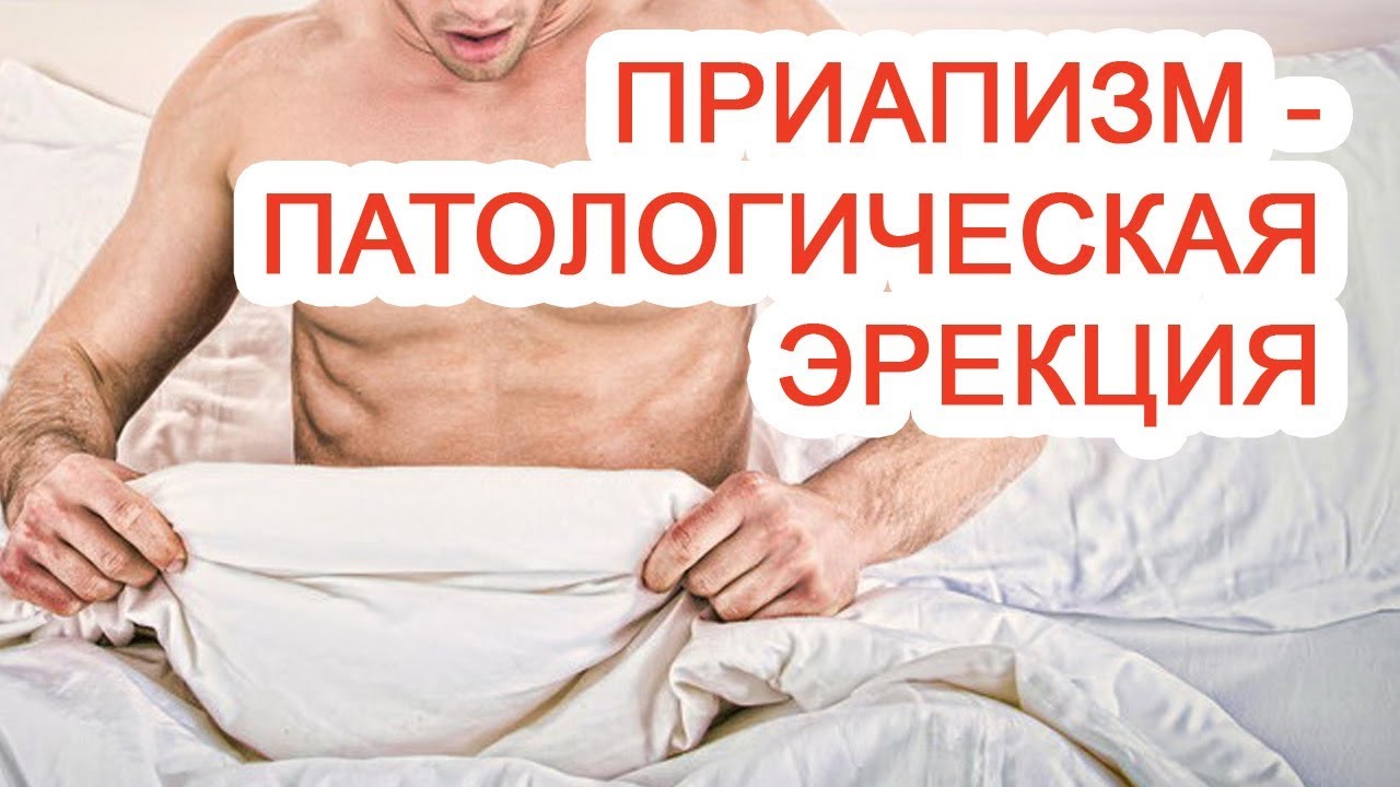 Почему пропадает эрекция 9 причин слабой эрекции у мужчин
