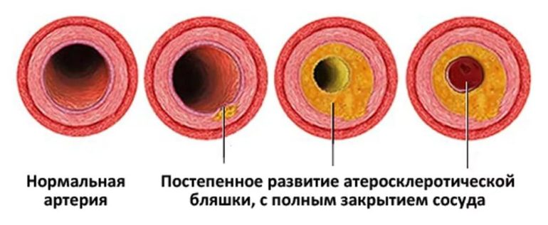 Useful › articles9 способов повысить потенцию без таблеток Клиника Наедине