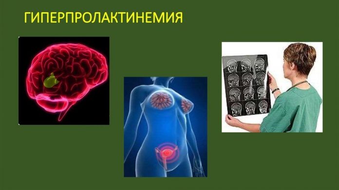 Проблемы с потенцией слабая, вялая что делать, как.